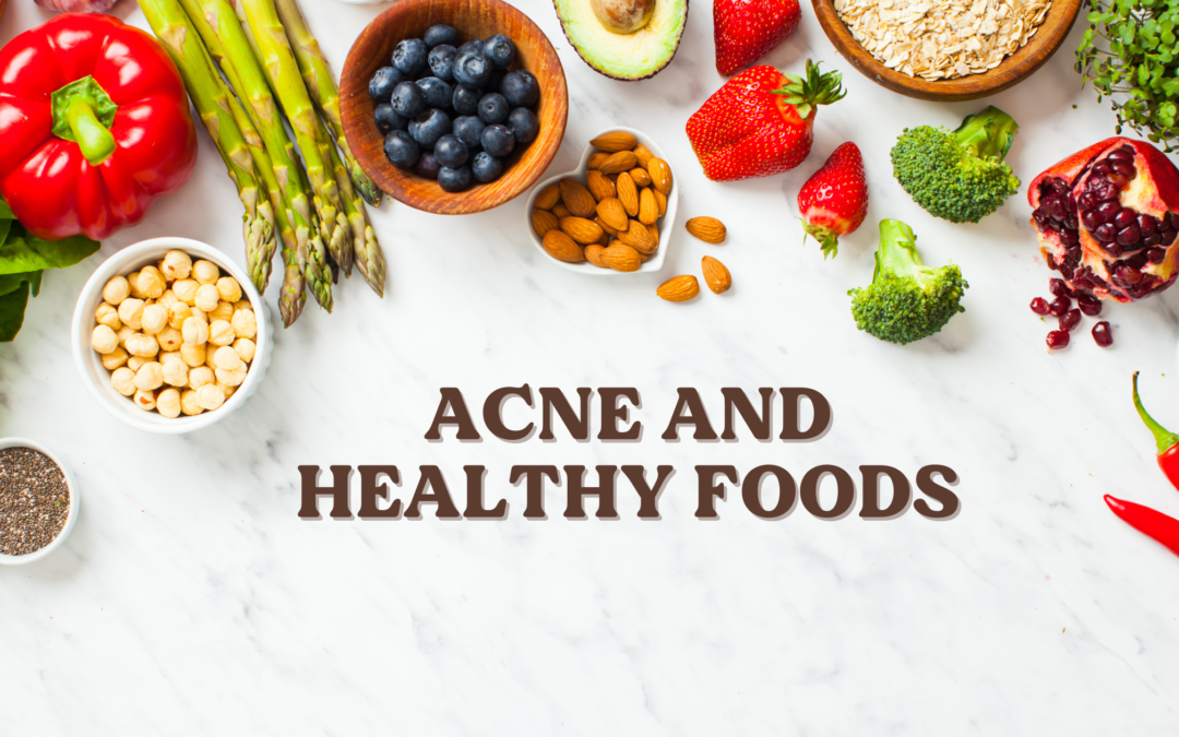 Acne and Healthy foods